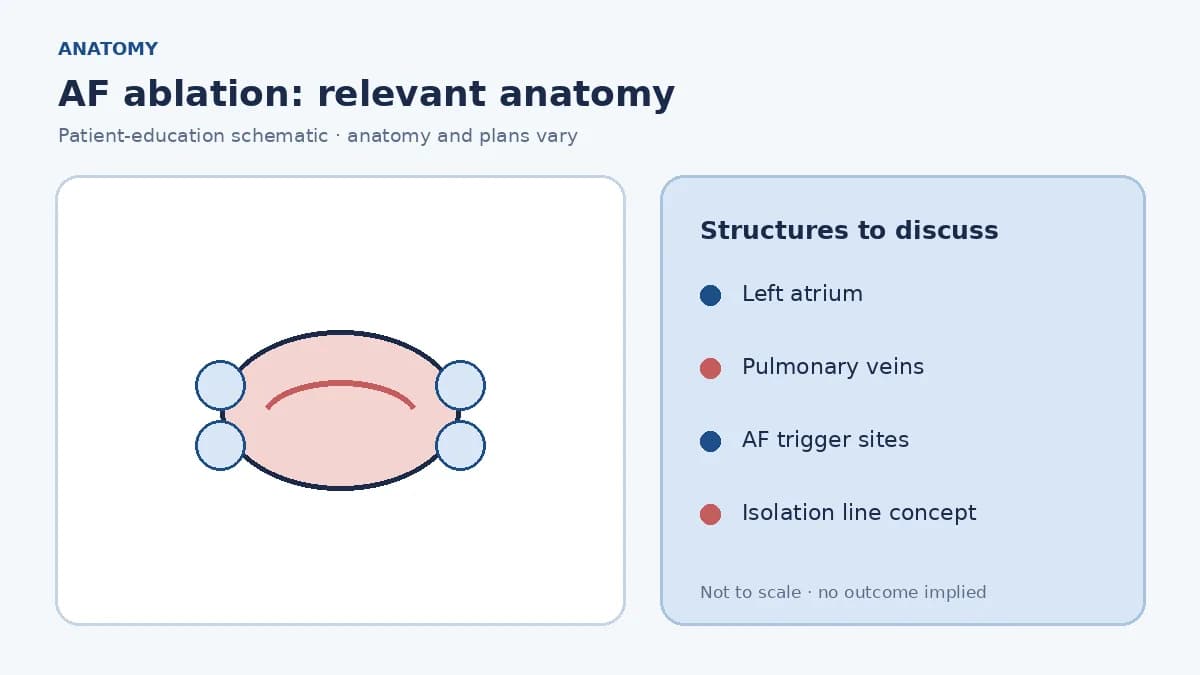 Medical illustration of the left atrium and pulmonary veins where atrial fibrillation triggers commonly arise