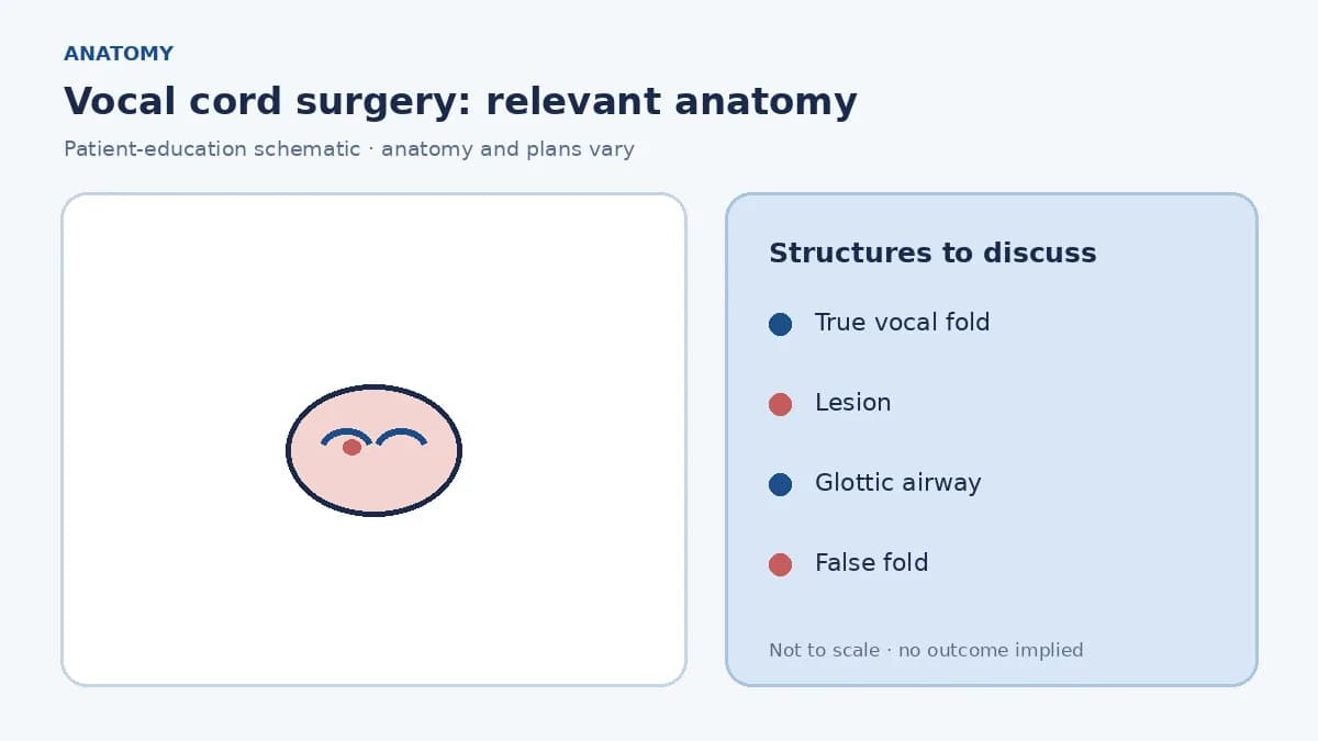 Medical illustration of the larynx and vocal folds showing a lesion on one cord