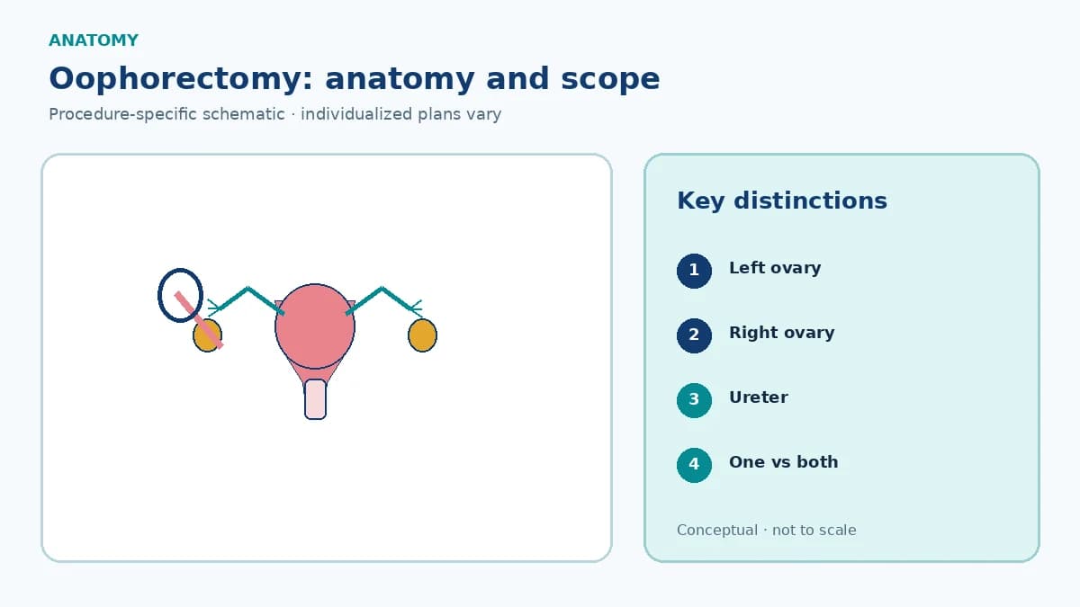 Patient-education pelvic schematic identifying left and right ovaries separately, adjacent tubes and ureters, and unilateral versus bilateral removal