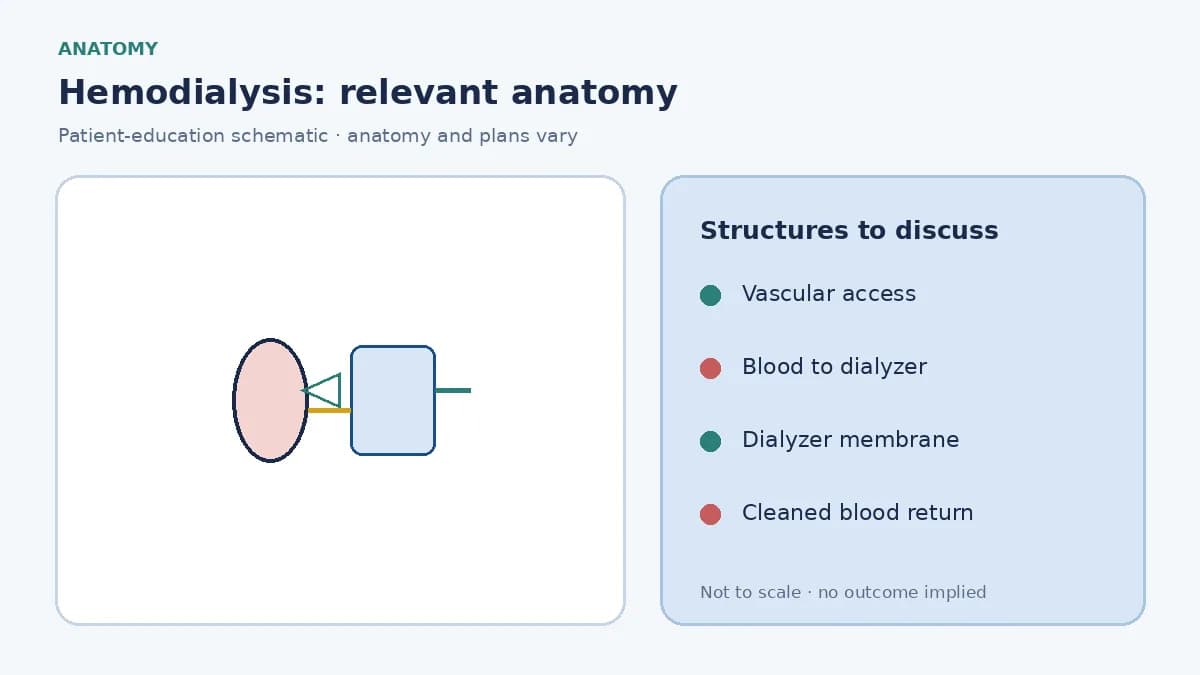 Medical infographic of hemodialysis showing vascular access, blood flow through a dialyzer and cleaned blood returning to the patient