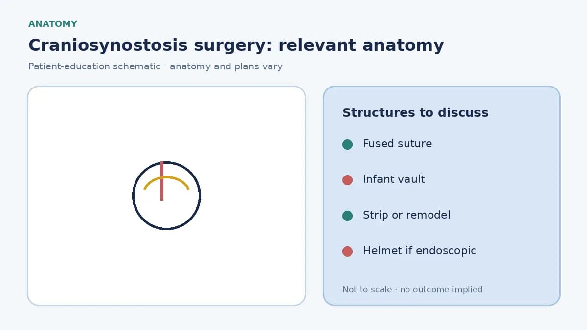 Medical illustration of an infant skull with a fused cranial suture causing compensatory head-shape change