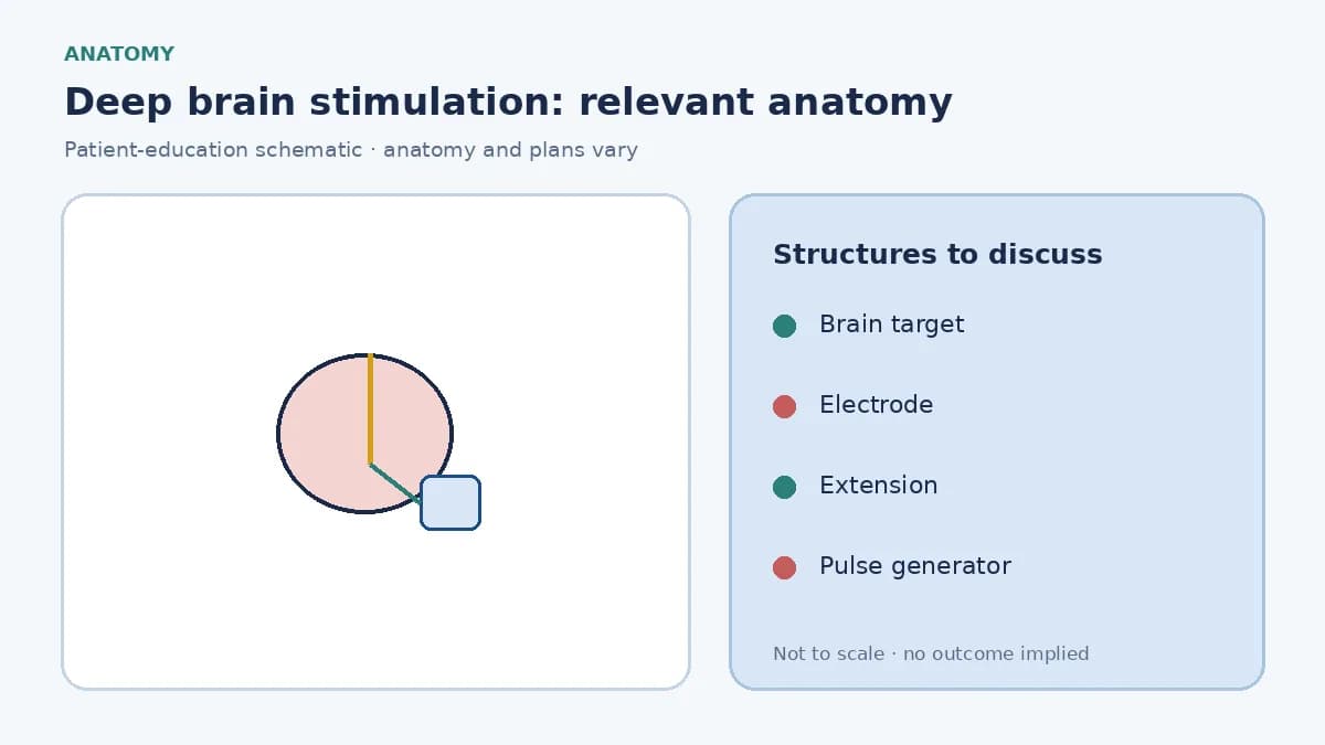 Medical illustration of deep-brain-stimulation targets in the basal ganglia and the planned electrode paths