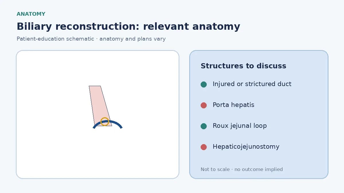 Medical illustration of the bile ducts and porta hepatis showing a stricture or injury that may need biliary reconstruction
