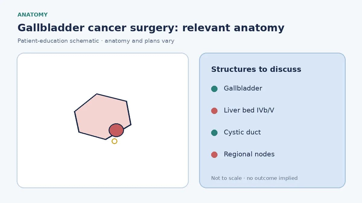 Medical illustration of the gallbladder, liver bed of segments IVb and V, and nearby bile duct involved in gallbladder cancer surgery