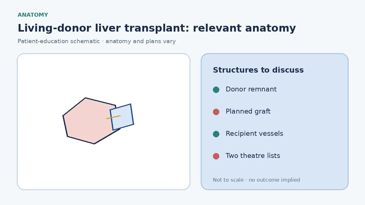 Medical illustration of living-donor liver anatomy showing a planned right or left graft and remnant liver