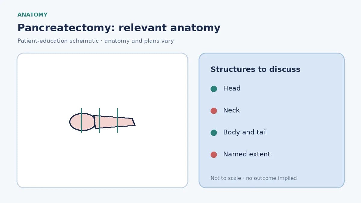 Medical illustration of the whole pancreas showing head, neck, body and tail so the extent of pancreatectomy can be discussed