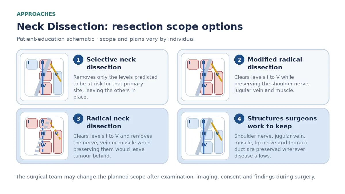 Medical infographic comparing selective neck dissection of the levels at risk, modified radical dissection preserving the shoulder nerve, vein and muscle, and radical dissection removing those structures.