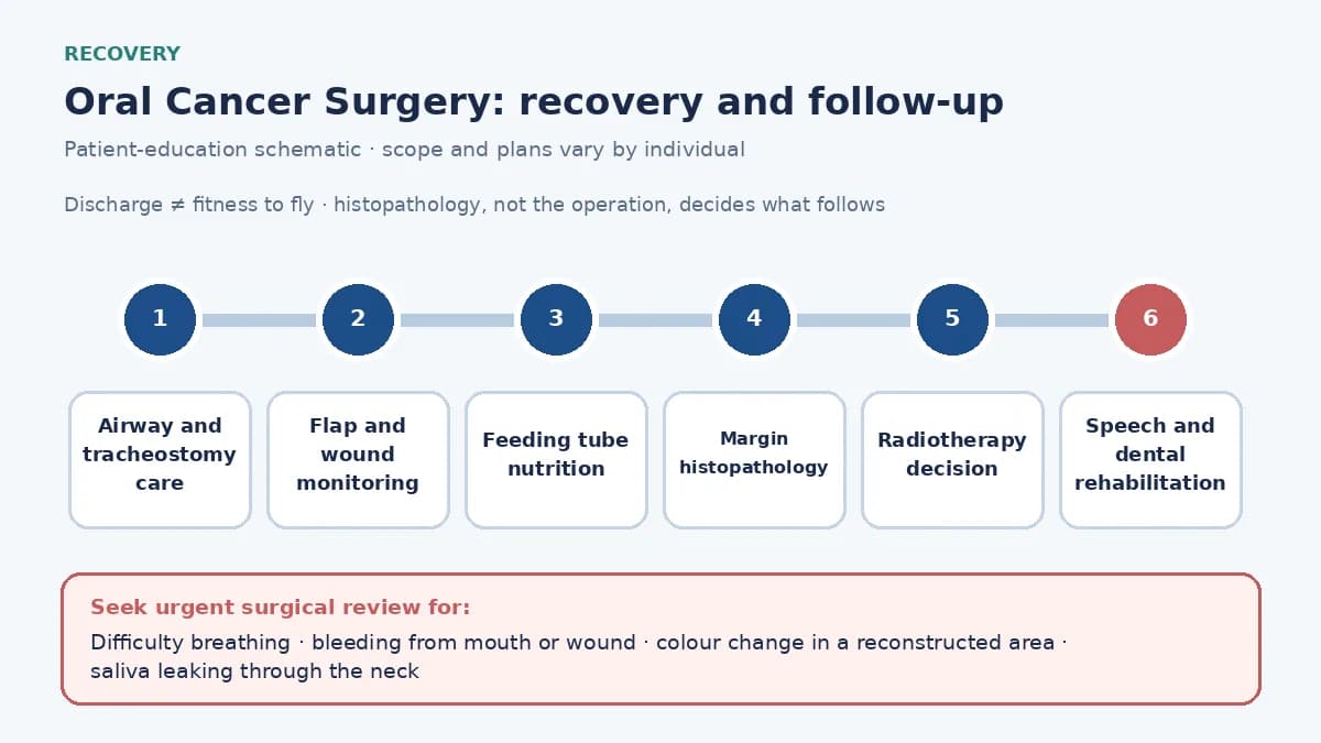Medical infographic of the oral cancer recovery pathway: airway and tracheostomy care, flap monitoring, feeding tube nutrition, margin histopathology, radiotherapy decision, speech therapy and dental rehabilitation.