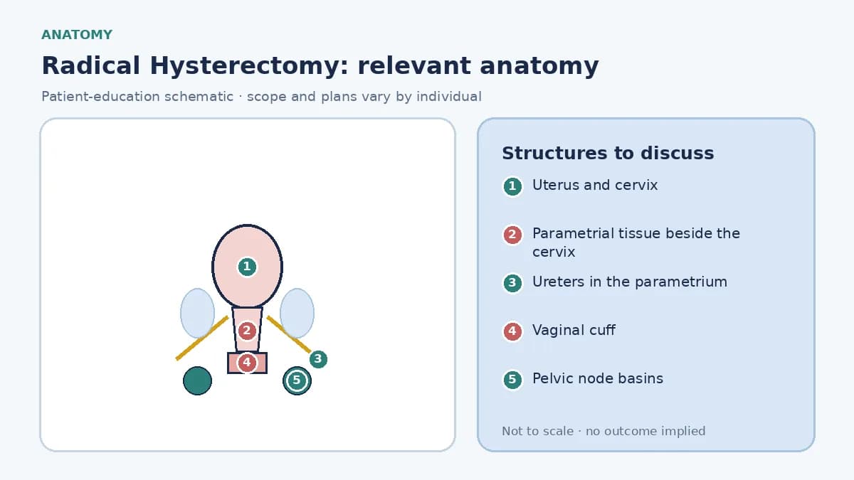 Medical illustration of pelvic anatomy for radical hysterectomy: uterus and cervix between bladder and rectum, ureters running through the parametrium, a vaginal cuff, and the pelvic node basins assessed with the specimen.