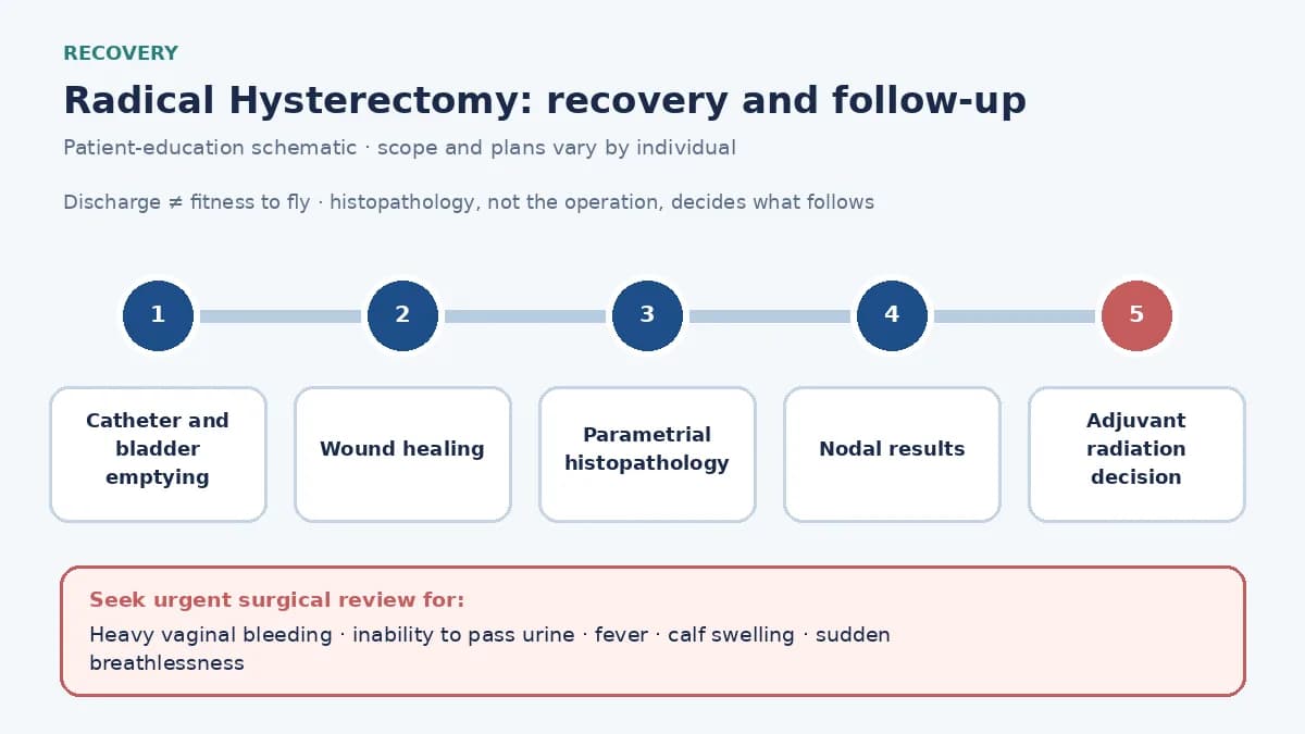 Medical infographic of the radical hysterectomy recovery pathway: catheter and bladder emptying, histopathology of parametrium and nodes, the adjuvant radiation decision, and surveillance.