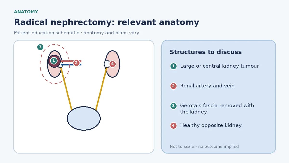 Medical infographic of radical nephrectomy anatomy showing a kidney with a large central tumour, the renal artery and vein, surrounding fatty fascia, the adrenal gland above and the healthy opposite kidney