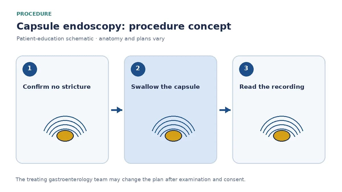 Clinical diagram of capsule endoscopy recording images of the small-bowel lining