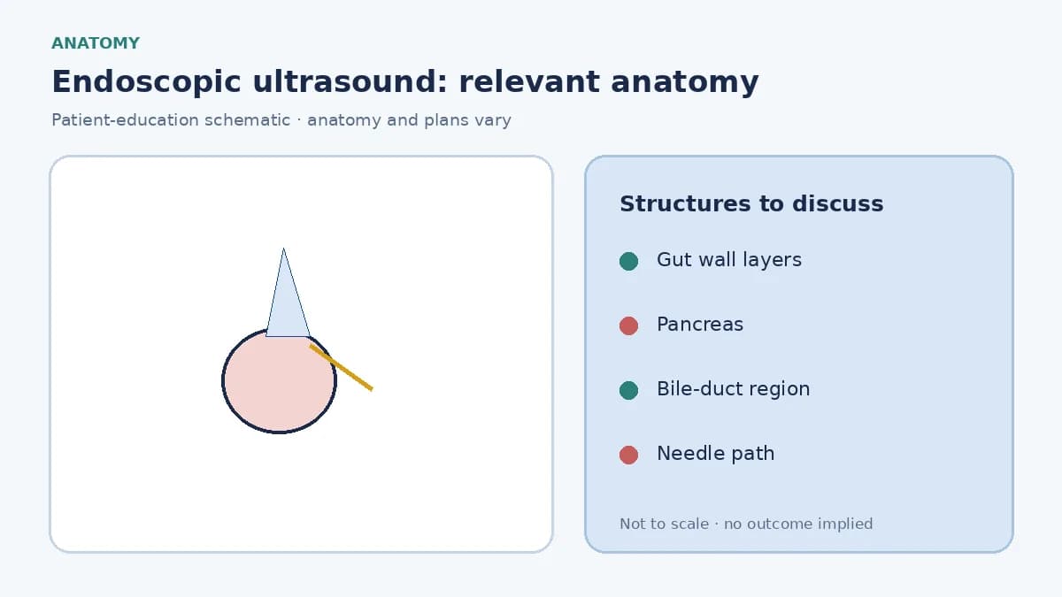 Medical illustration of the stomach wall and pancreas as imaged from inside the gut during EUS