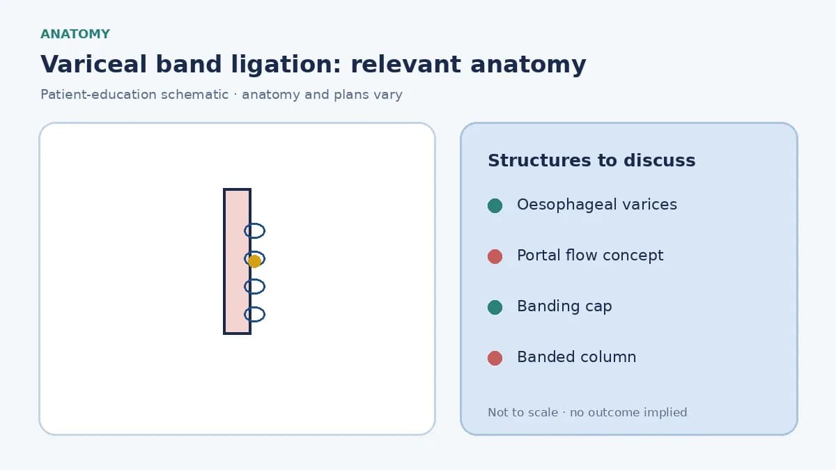 Medical illustration of oesophageal varices in a patient with portal hypertension