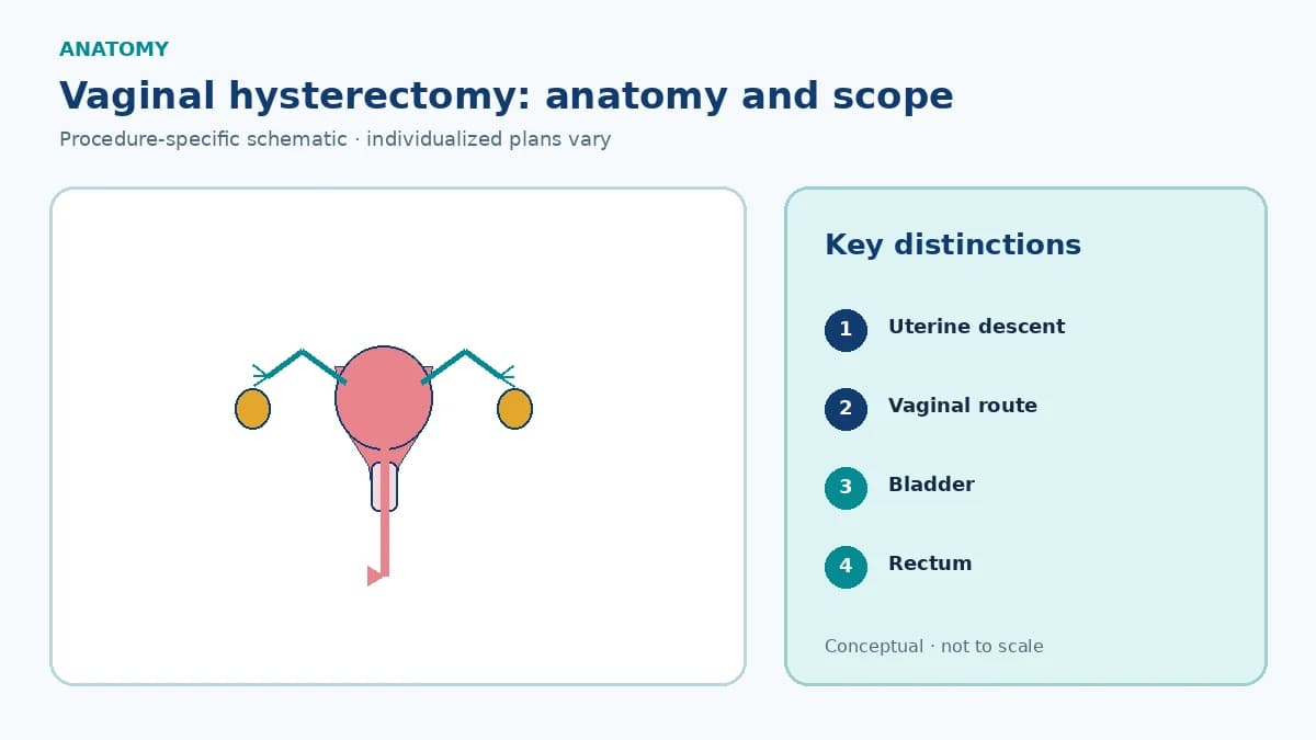 Patient-education sagittal pelvic schematic showing uterine descent, vaginal removal route, bladder, rectum and the apical support relationship