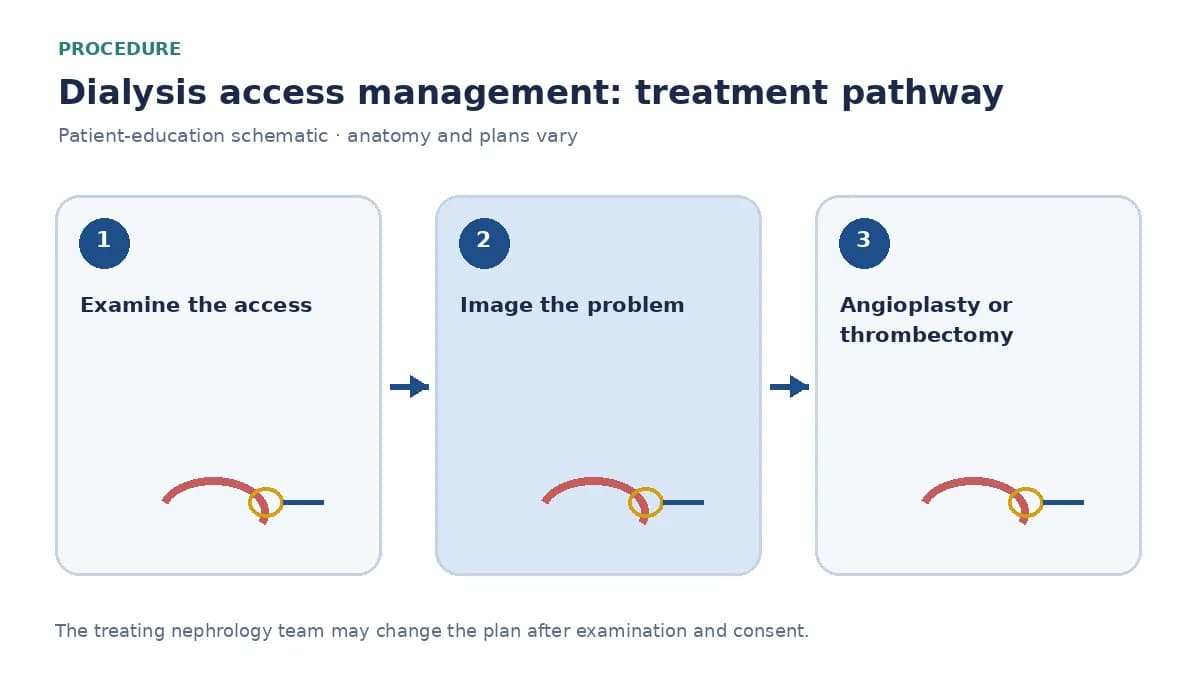 Step-by-step dialysis-access-management pathway showing examination, fistulogram and salvage intervention