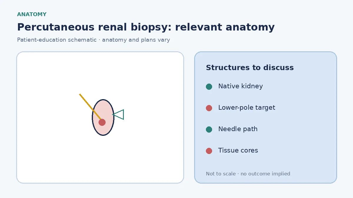 Medical infographic of native-kidney anatomy showing an image-guided biopsy needle path into the renal cortex