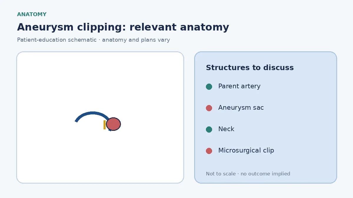 Medical illustration of an intracranial aneurysm on a cerebral artery showing the sac and neck