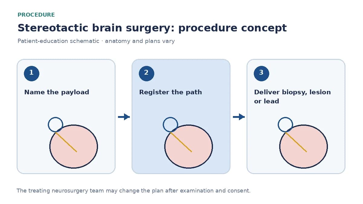 Clinical diagram of stereotactic brain surgery delivering a biopsy needle, lesion or lead along a planned path