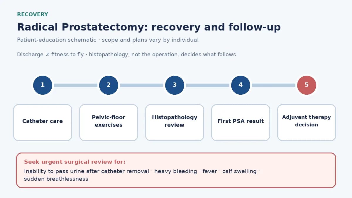 Medical infographic of the radical prostatectomy recovery pathway: catheter care, pelvic-floor exercises, histopathology, the first PSA, and the adjuvant radiation or systemic-therapy decision.