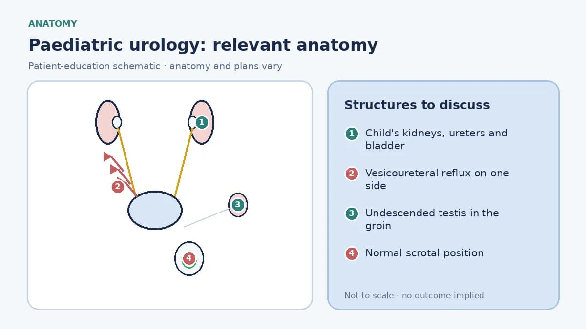 Medical infographic of paediatric urology anatomy showing a child's kidneys, ureters and bladder with vesicoureteral reflux on one side, an undescended testis in the groin and the normal scrotal position